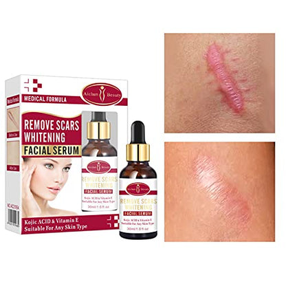 AICHUN BEAUTY Scar Removal Facial Serum Pimples Stretch Marks Face Moisturizing Body Remove Scars Kojic Acid Vitamin E 30ml