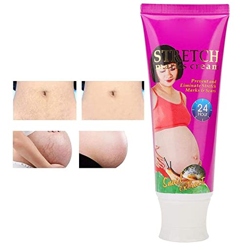 AICHUN BEAUTY Stretch Marks Cream Snail Extract Reduce Skin Scars Remove Damaged Skin Cells 120g/4.23oz