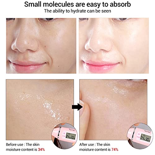 AICHUN BEAUTY Face Serum Eye Essence Anti-Wrinkles Anti-Acne Oil-Control Anti-Freckle Refreshing Moisturizing Purifying Shrink Pores 30ml 1.01FL.oz