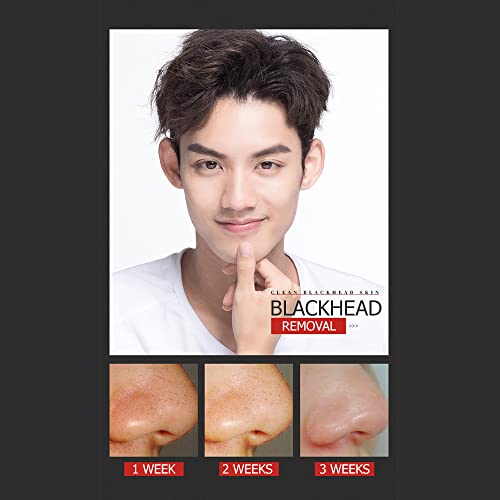 VENZEN Men's Cool Blackhead Removal Essence Nose Mask Pores Cleansing Water Kit 3pcs Set