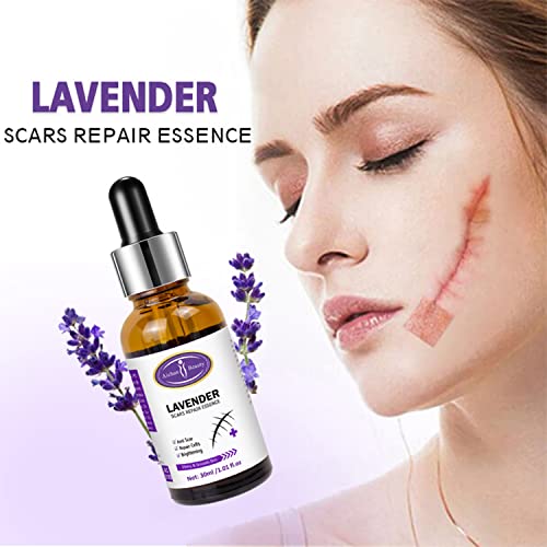 AICHUN BEAUTY Scars Repair Essence Lavender Extract Essential Oil Anti Scar Repair Cells Shiny Smooth Skin Care 30ml/1.01fl.oz