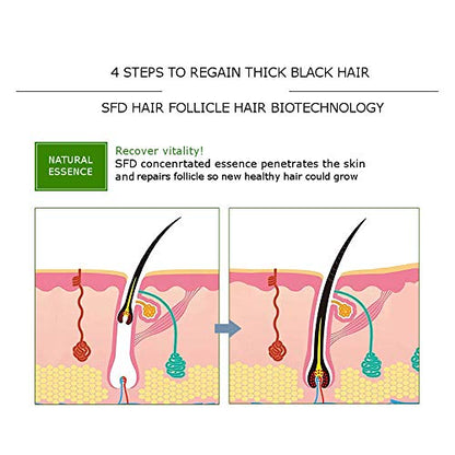 DISAAR BEAUTY Natural Hair Growth Serum Ginger Essential Oil Hair Growth Oil Anti Hair Loss Essence Hair Thinning Treatment Healthy Strong Thick Hair Treats Baldness Weak Brittle Thinning Hair