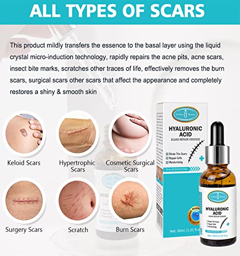 AICHUN BEAUTY Hyaluronic Acid Scars Repair Essence Repair Cells Serum Moisturizing Essential Oil Skin Scar Removal Nourish Hydrate 30ml/1.01fl.oz