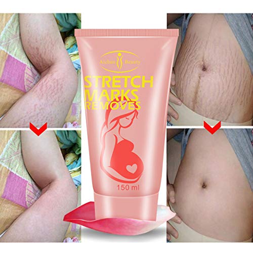 AICHUN BEAUTY Pregnancy Cream Stretch Mark Remover Scars Repair Cellulites Lotion Cream 150ml