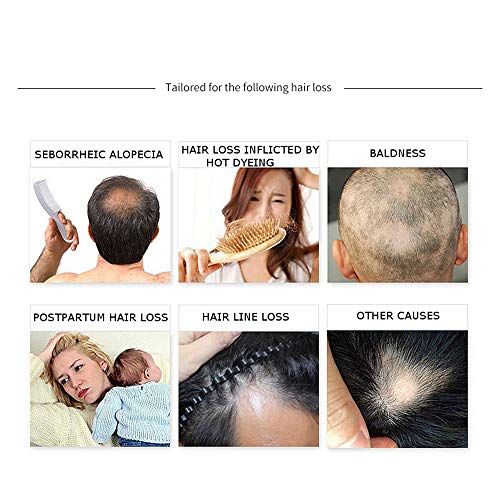 DISAAR BEAUTY Hair Growth Essential Oil Natural Plant Dry Growth Essence Anti Hair Loss Scalp Treatments Genseng Raise Dense 30g