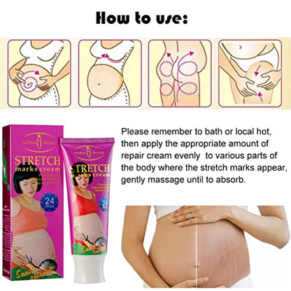 AICHUN BEAUTY Stretch Marks Cream Snail Extract Reduce Skin Scars Remove Damaged Skin Cells 120g/4.23oz