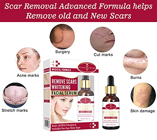 AICHUN BEAUTY Scar Removal Facial Serum Pimples Stretch Marks Face Moisturizing Body Remove Scars Kojic Acid Vitamin E 30ml