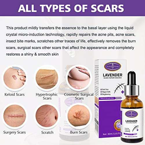 AICHUN BEAUTY Scars Repair Essence Lavender Extract Essential Oil Anti Scar Repair Cells Shiny Smooth Skin Care 30ml/1.01fl.oz