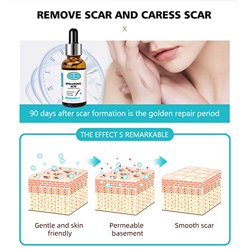 AICHUN BEAUTY Hyaluronic Acid Scars Repair Essence Repair Cells Serum Moisturizing Essential Oil Skin Scar Removal Nourish Hydrate 30ml/1.01fl.oz