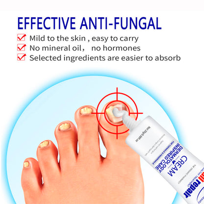 AICHUN BEAUTY Nail Repair Cream Toenails Fingernails Care Anti Fungus Restores Damaged Nails Nourishes Hydrates Skin 20g / 0.68fl.oz