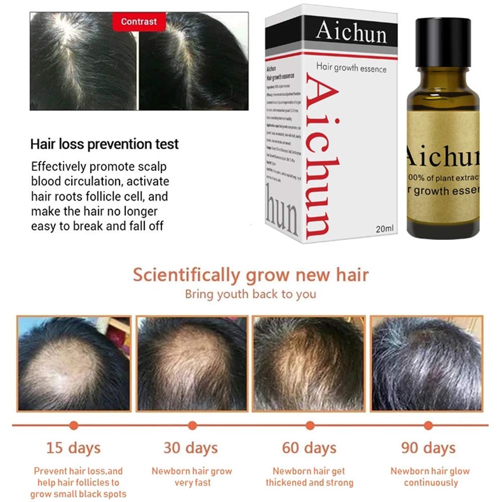 Aichun Hair Growth Essence 100% Plant Extract Hair Loss Scalp Treatments Ginger Genseng Raise Dense Hair Stop Liquid For Damaged Hair Enhance Your Overall Hair Condition 20ml